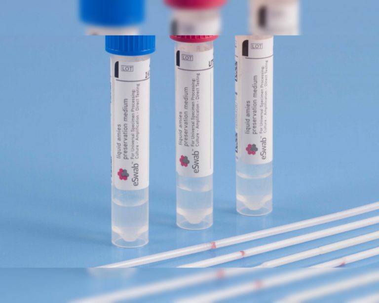 DE LUCA: ACCELERARE SULL’ESITO DEI TAMPONI